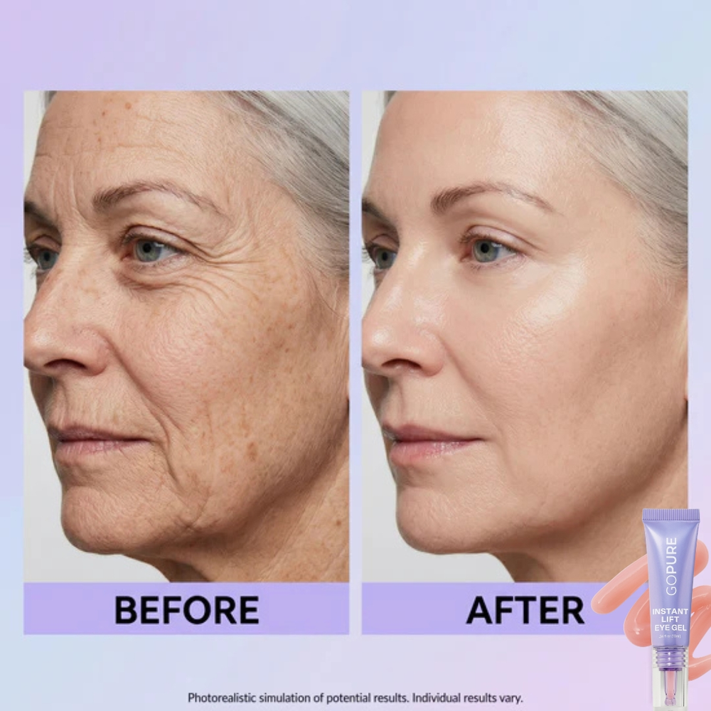 SPECIAL LAUNCH PRICE | GOPURE™ Instant Lift Eye Gel | For Puffiness & Bags, Wrinkles, Fine Lines and Dark Circles